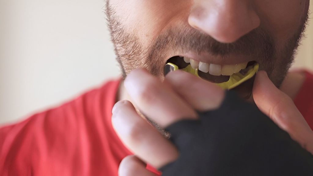 mouthguards in woodbridge il
