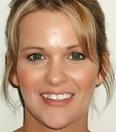 restorative with overbite