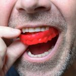 Do You Really Need a Mouth Guard? Here’s When and Why It Matters