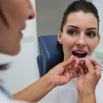 how custom mouthguards protect more than just your teeth